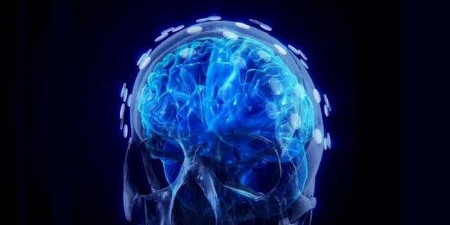 Aider les patients à récupérer après un AVC